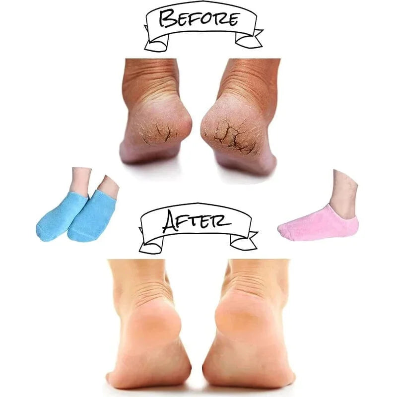 Feuchtigkeitsspendende Socken mit Spa-Gel-Futter