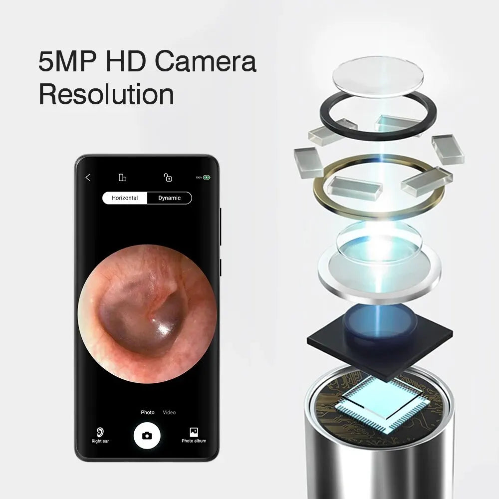 KERUI Smart Wireless Visual Ohrreiniger Löffel Sichere Endoskop Ohrpick 5MP Mini Kamera Ohrenschmalz Entferner Otoskop Ohr Werkzeuge Gesundheitsversorgung