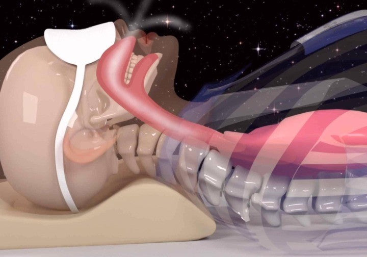 Respiro - Das Kissen für besseren Schlaf und weniger Schnarchen