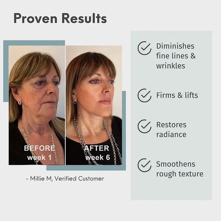 Collagen Boost Anti-Aging Serum