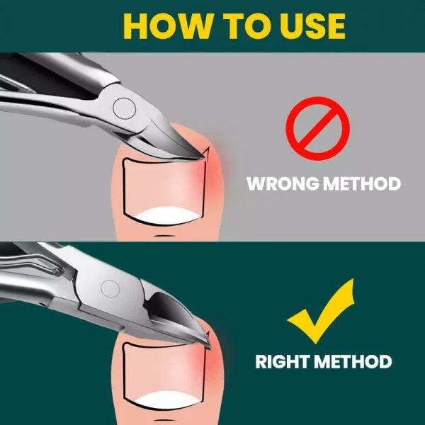 Orthopädische Nagelschneider