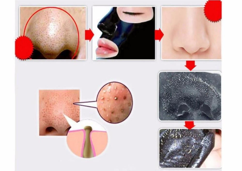 Reinigende Tiefenreinigung Peel-off Schwarze Maske