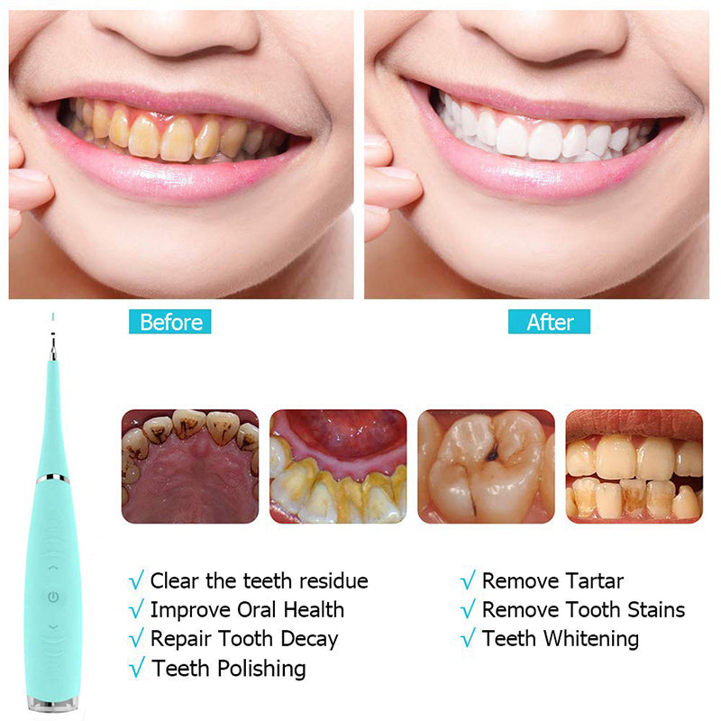 Sandsberg | Zahnseide