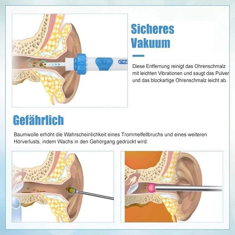 Sandsberg | Ohrenschmalz-Entferner-Vakuum