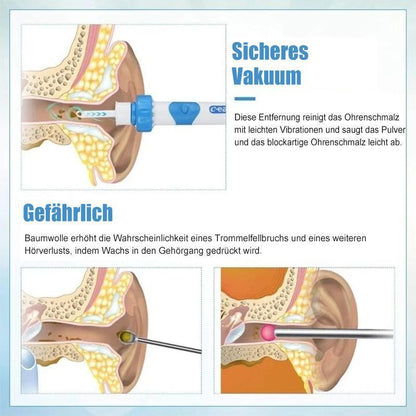 Sandsberg | Ohrenschmalz-Entferner-Vakuum