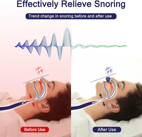 Micro-CPAP-Schlafapnoe-Maschine für Reisen & Anti-Schnarchen - CPAP-Alternative