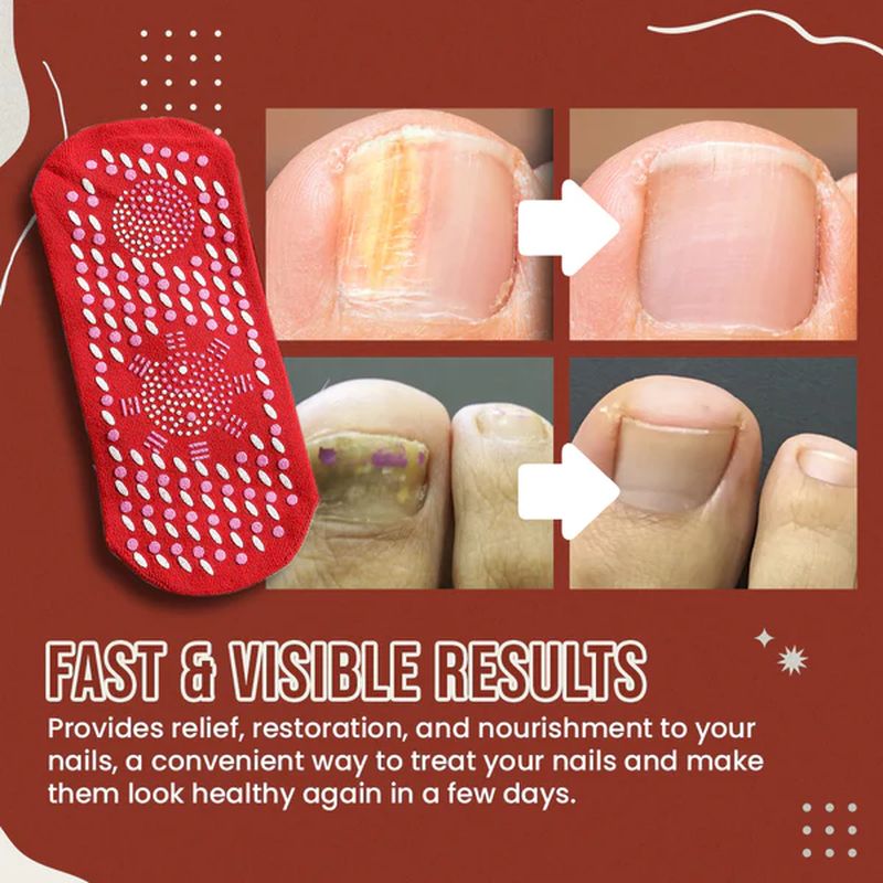 Sandsberg | Nagel Anti-Pilz Socken