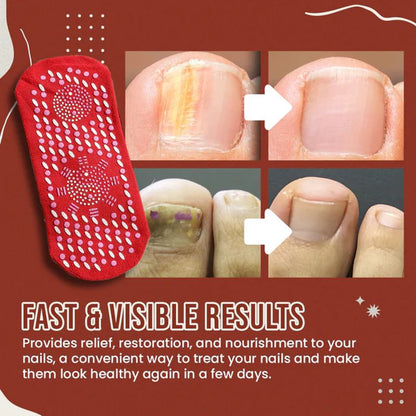 Sandsberg | Nagel Anti-Pilz Socken