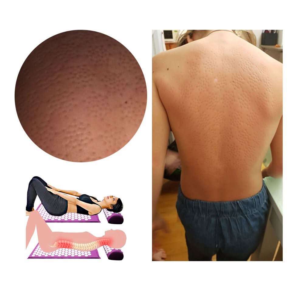 Sandsberg | Akupressur-Yogamatte & Kissentセット für natürliche Schmerzlinderung & Entspannung