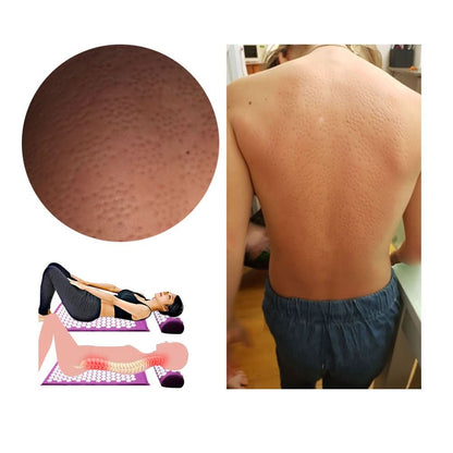 Sandsberg | Akupressur-Yogamatte & Kissentセット für natürliche Schmerzlinderung & Entspannung