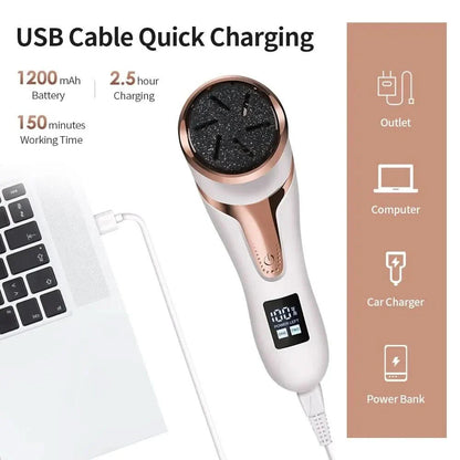 Sandsberg | Wiederaufladbarer Hornhautentferner für seidig weiche Füße