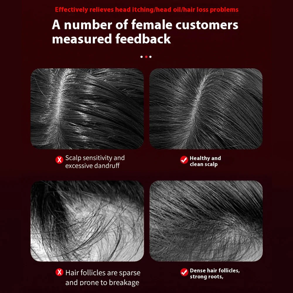 Sandsberg | Tragbarer elektrischer Kopfhautmassagekamm