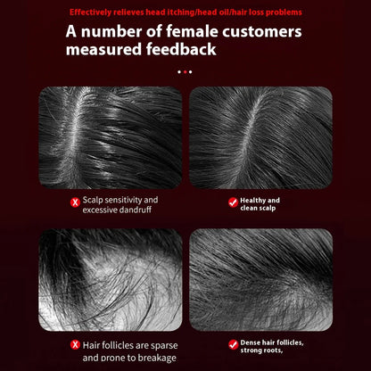 Sandsberg | Tragbarer elektrischer Kopfhautmassagekamm