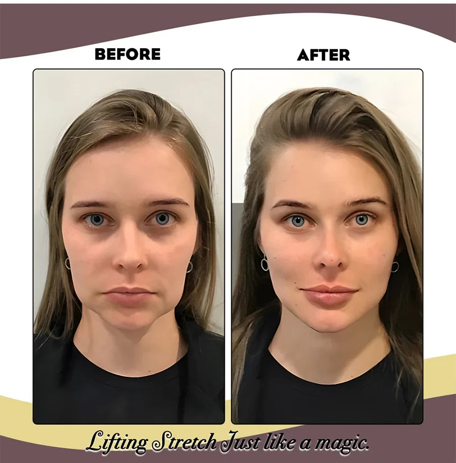 Sandsberg | Elastisches Gesichts-Lifting-Band