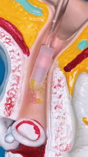 Sandsberg | Wiederverwendbarer Klebriger Ohrenreiniger 24 Stück